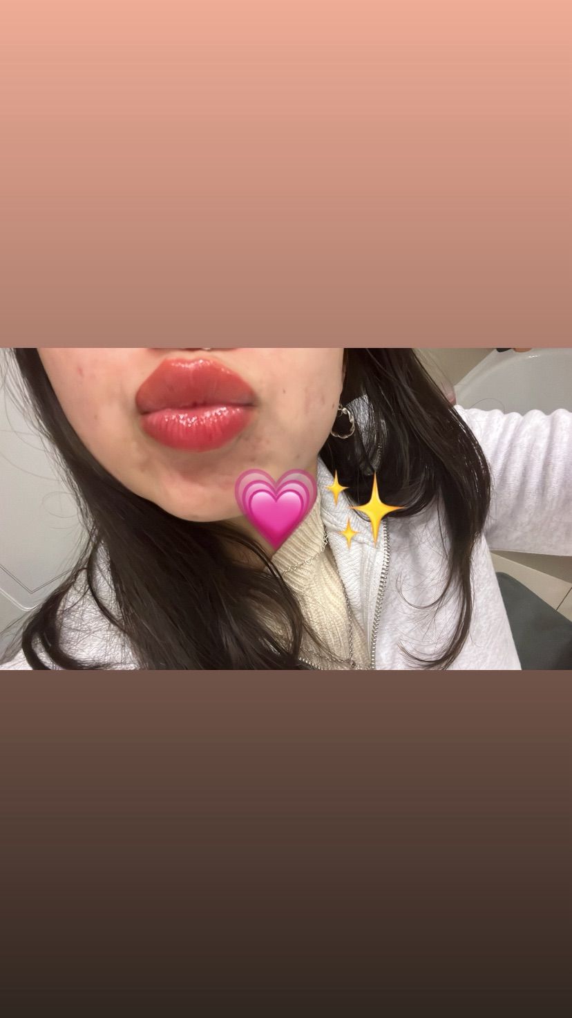 🎀✨