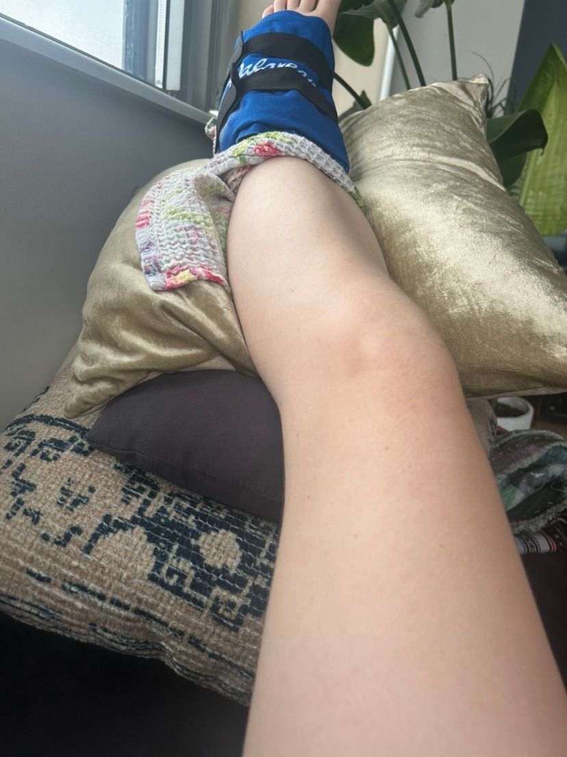 i sprained my ankle ( ´△｀)