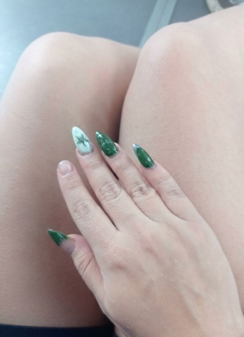 I was playing and I lost one of my nails 
:(